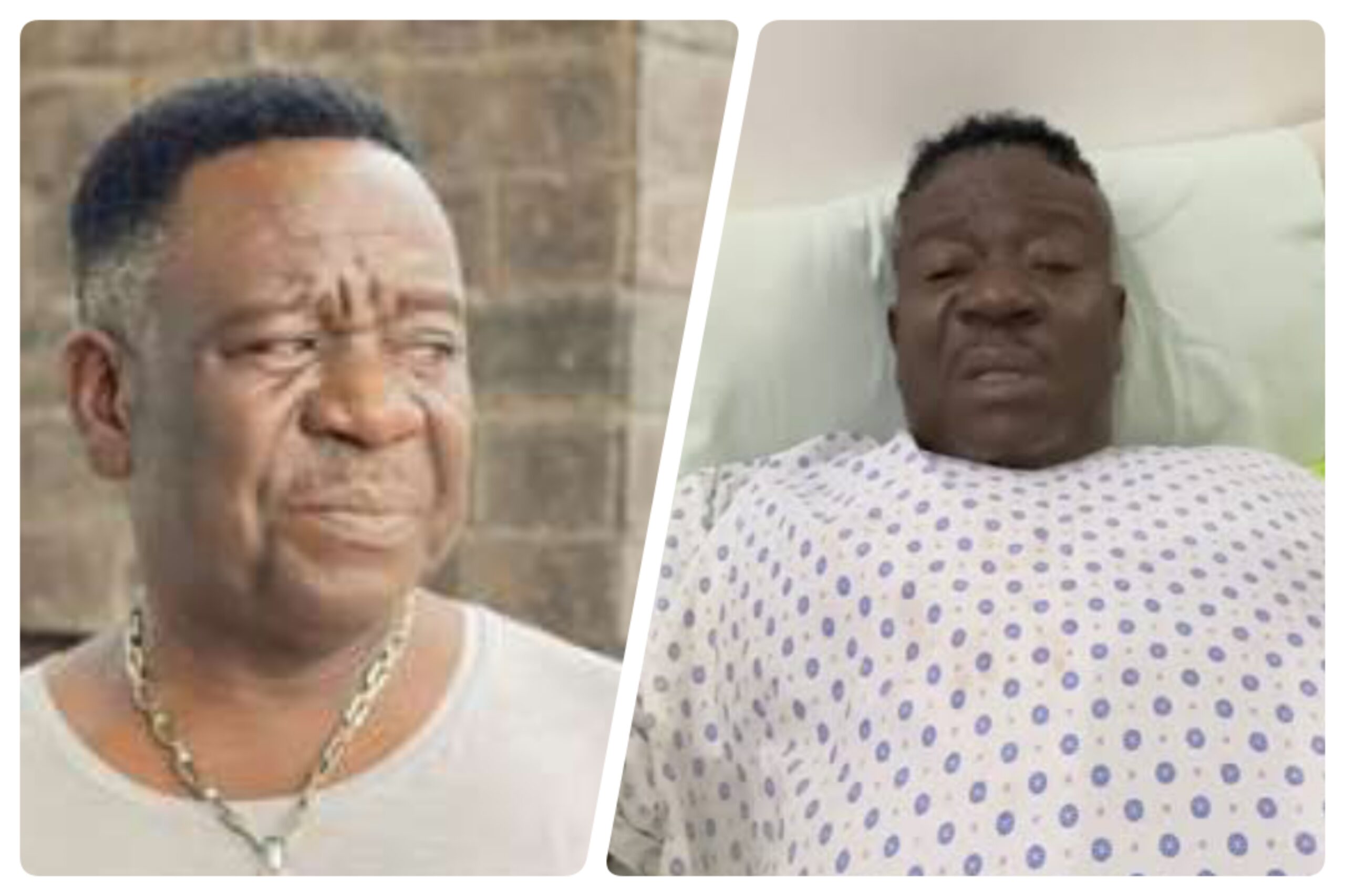 Mr Ibu: Why Nollywood Actor’s Leg Was Amputated After 7 Surgeries ...